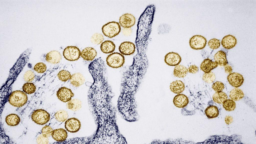 what-is-hantavirus,-the-disease-that-caused-the-death-of-3-passengers-on-a-cruise-ship-in-argentina